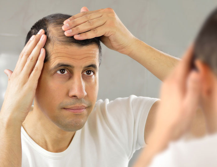 Hair Restoration Men Phoenix AZ