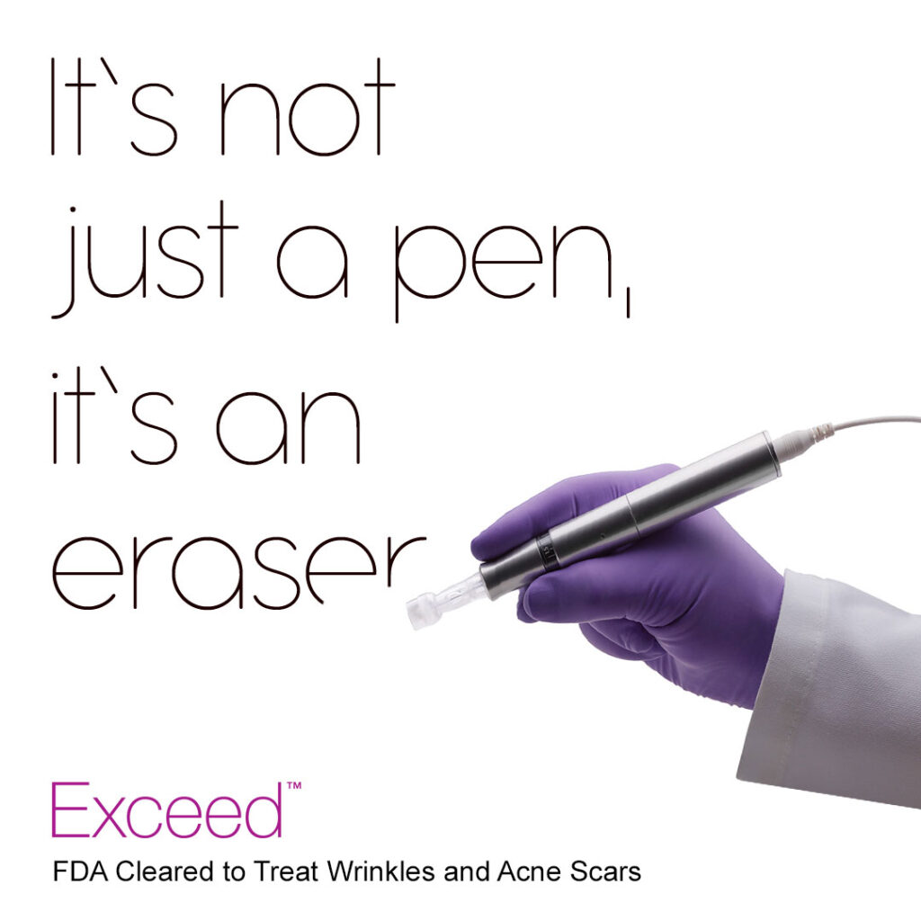 Exceed Microneedling Not Just a Pen